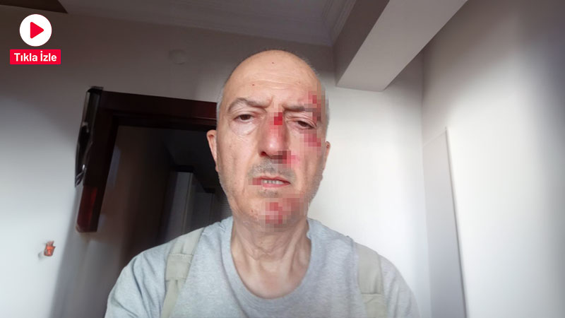 Afyonkarahisar’da boşanma sürecinde olan bir adam, eşi tarafından satıldığı iddia